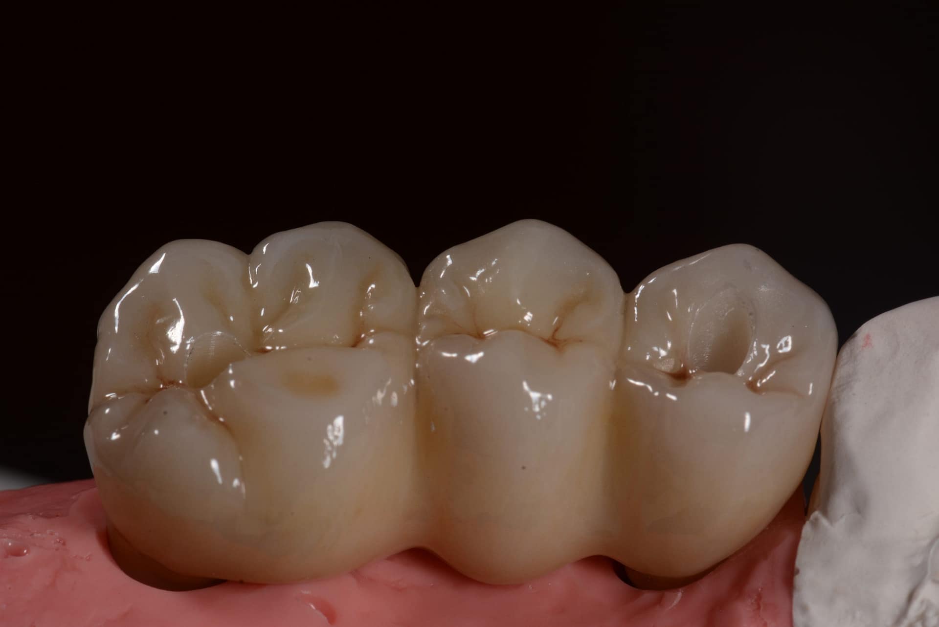 Module 3 Dental Implant Prosthetics Course MIAMI Institute